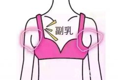 有了副乳怎么办？两个方法帮你轻松消除副乳