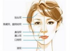 怎么快速去除鱼尾纹？睡眠、护肤、饮食、医美都可用