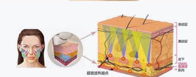 超声刀美容
