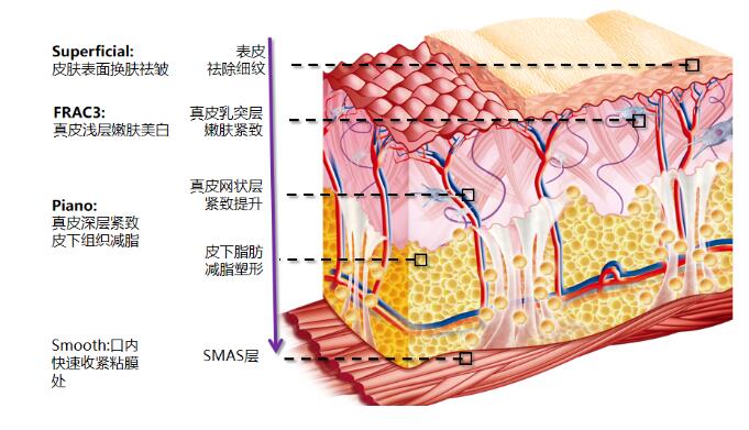 针对于5gmax极速提拉是交智商税吗?