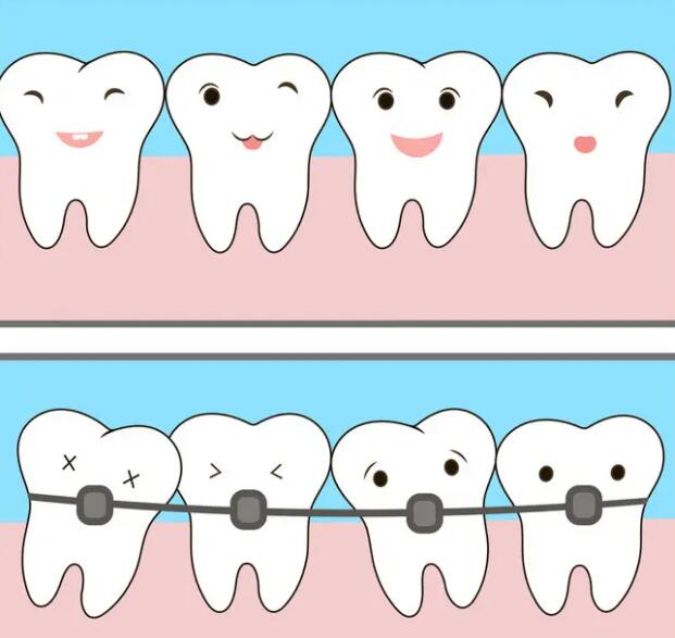 矫正牙齿的佳年龄是多少?