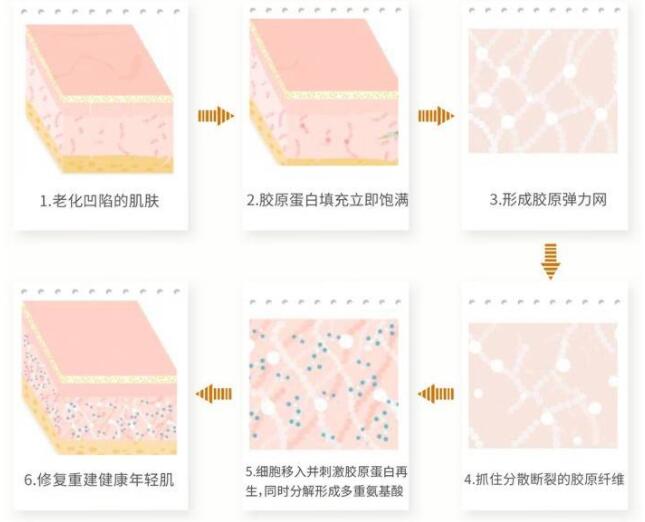 骨胶原填充面部价格多少?