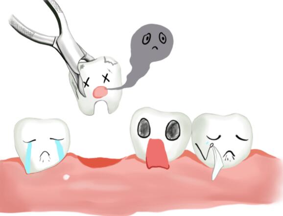 拔牙相关情况介绍