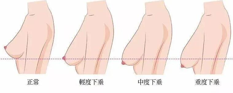 乳房护理的注意事项