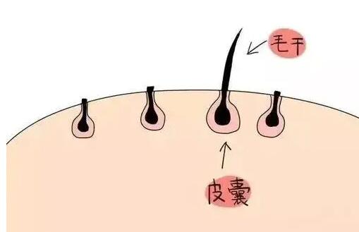 植发可以维持多久呢?