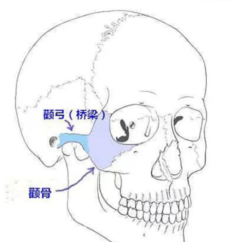 上海九院整形外科颧骨内推案例分享