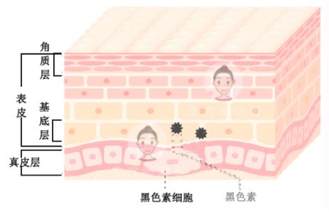 涂抹祛斑产品