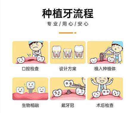 广东省人民医院牙齿种植案例分享