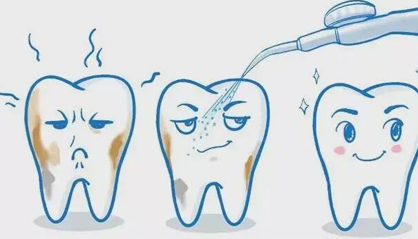 洗牙到底能不能够让牙齿变白呢?