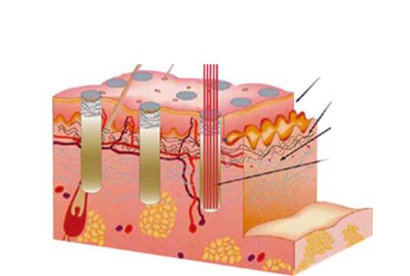 激光祛痘的原理和优势