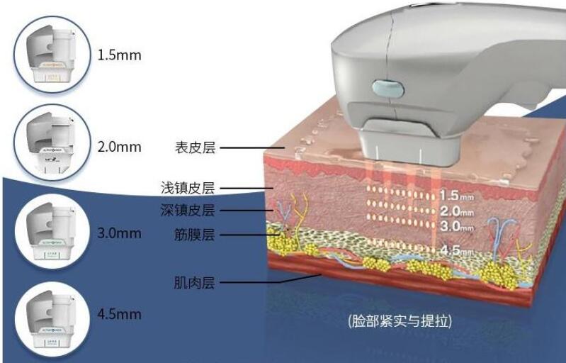 上海华山医院整形科热玛吉案例分享