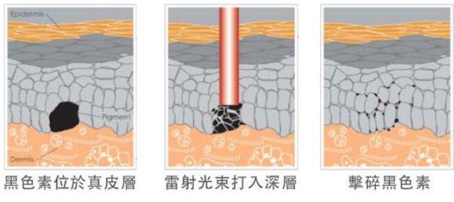 枣庄市立医院整形美容科科普知识