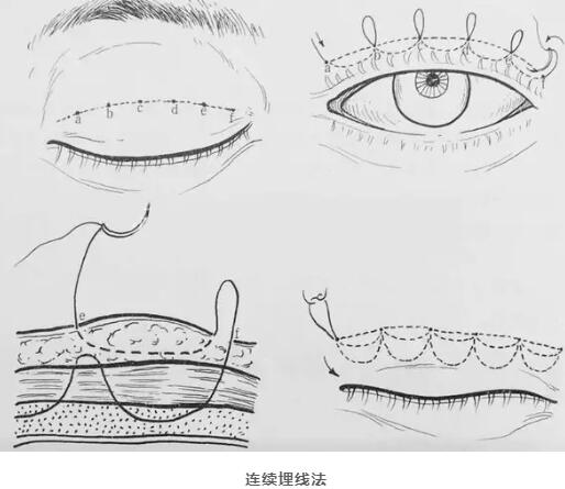 泰安88医院美容整形科科普知识