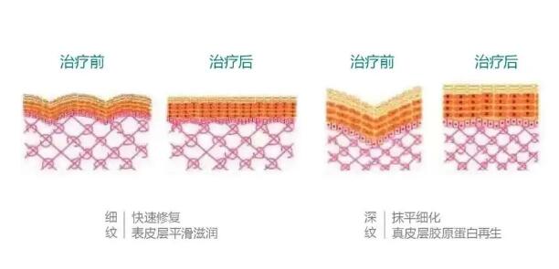 哺乳期可以做欧洲之星吗?