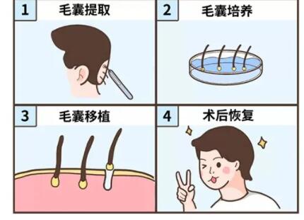 鞍山发际线种植一个单位价格是多少?