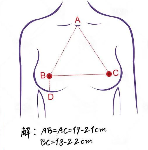 假体隆胸不良的反应多久会消失?