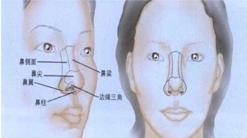 硅胶假体隆鼻手术