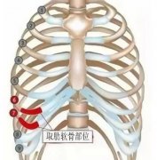 肋骨隆鼻可以维持一辈子吗？肋骨隆鼻的原理深入探查！