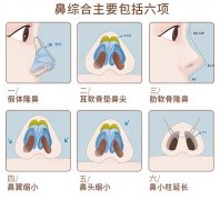 假体隆鼻的危害有哪些？